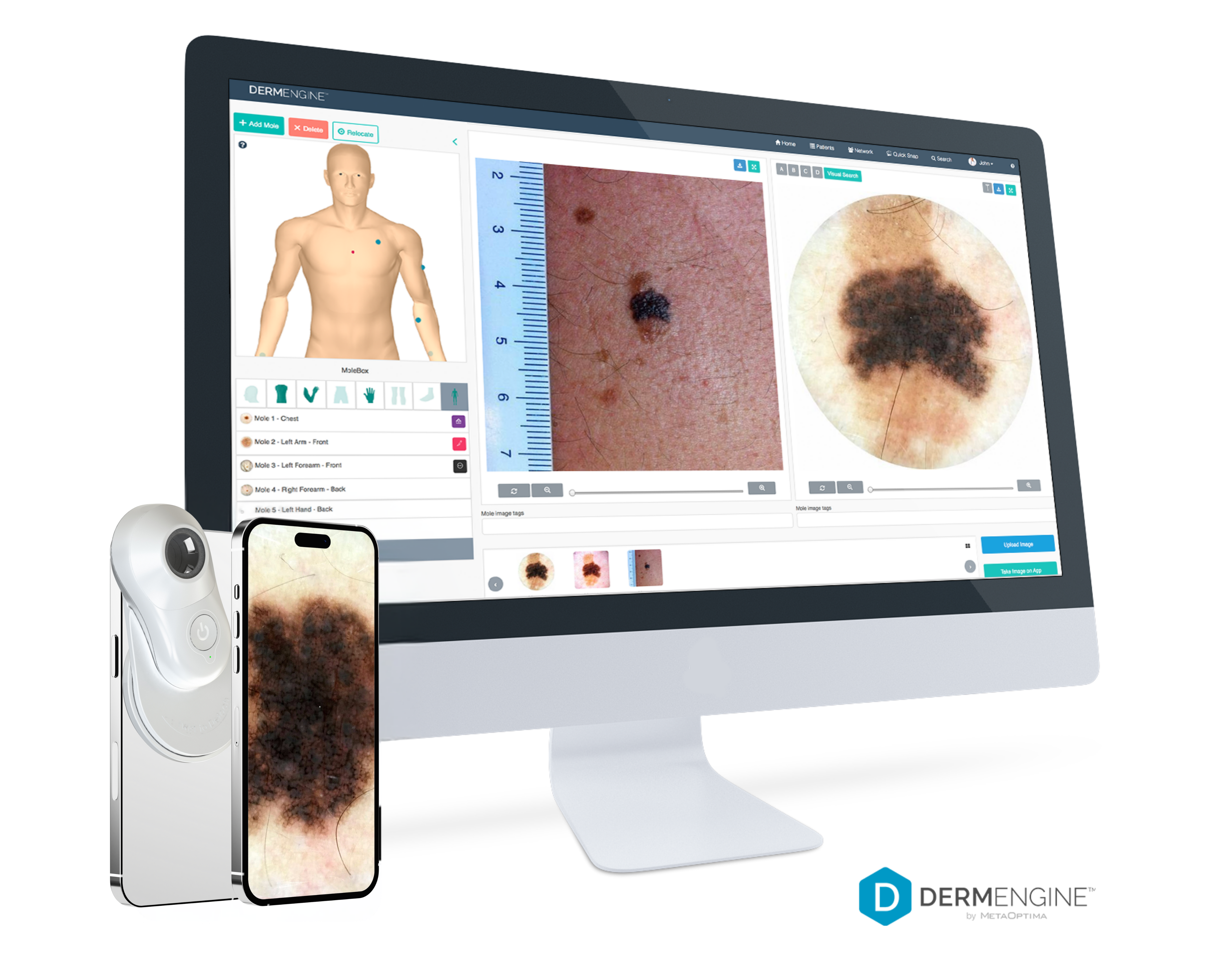 DermEngine_DermEngine