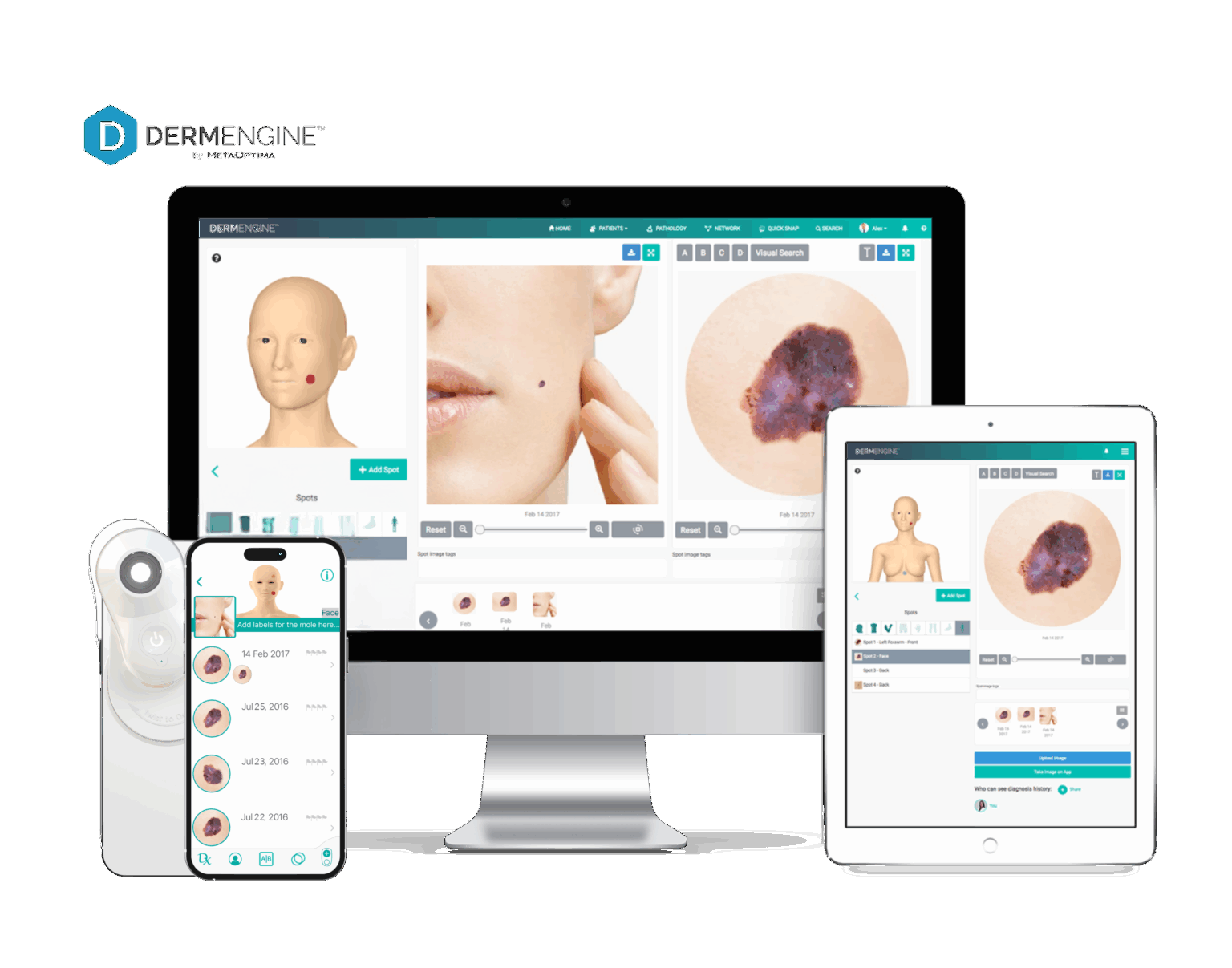 DermEngine_devices_MoleScopeII