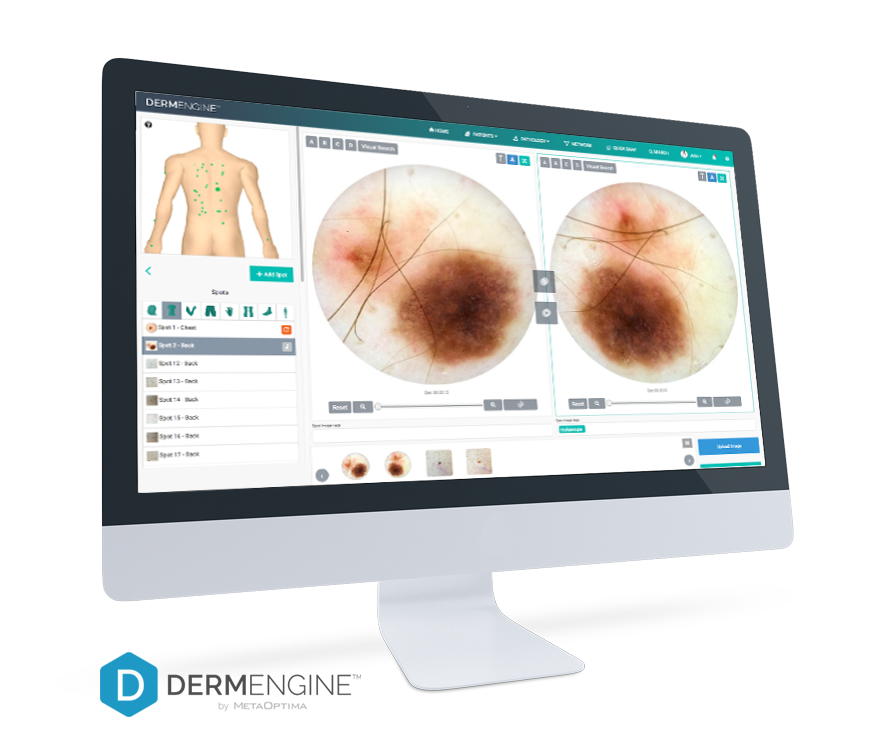 DermEngine_evolutionTracker